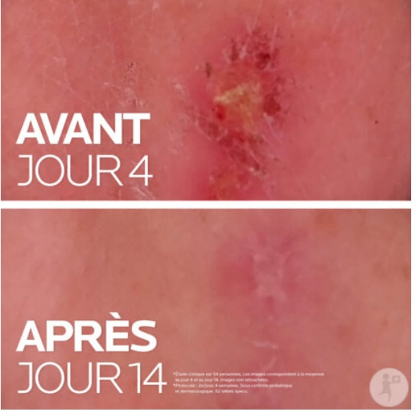 La Roche-posay - Cicaplast balm b5