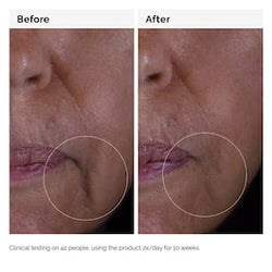 THE ORDINARY
Solution GF 15% - Sérum anti-age